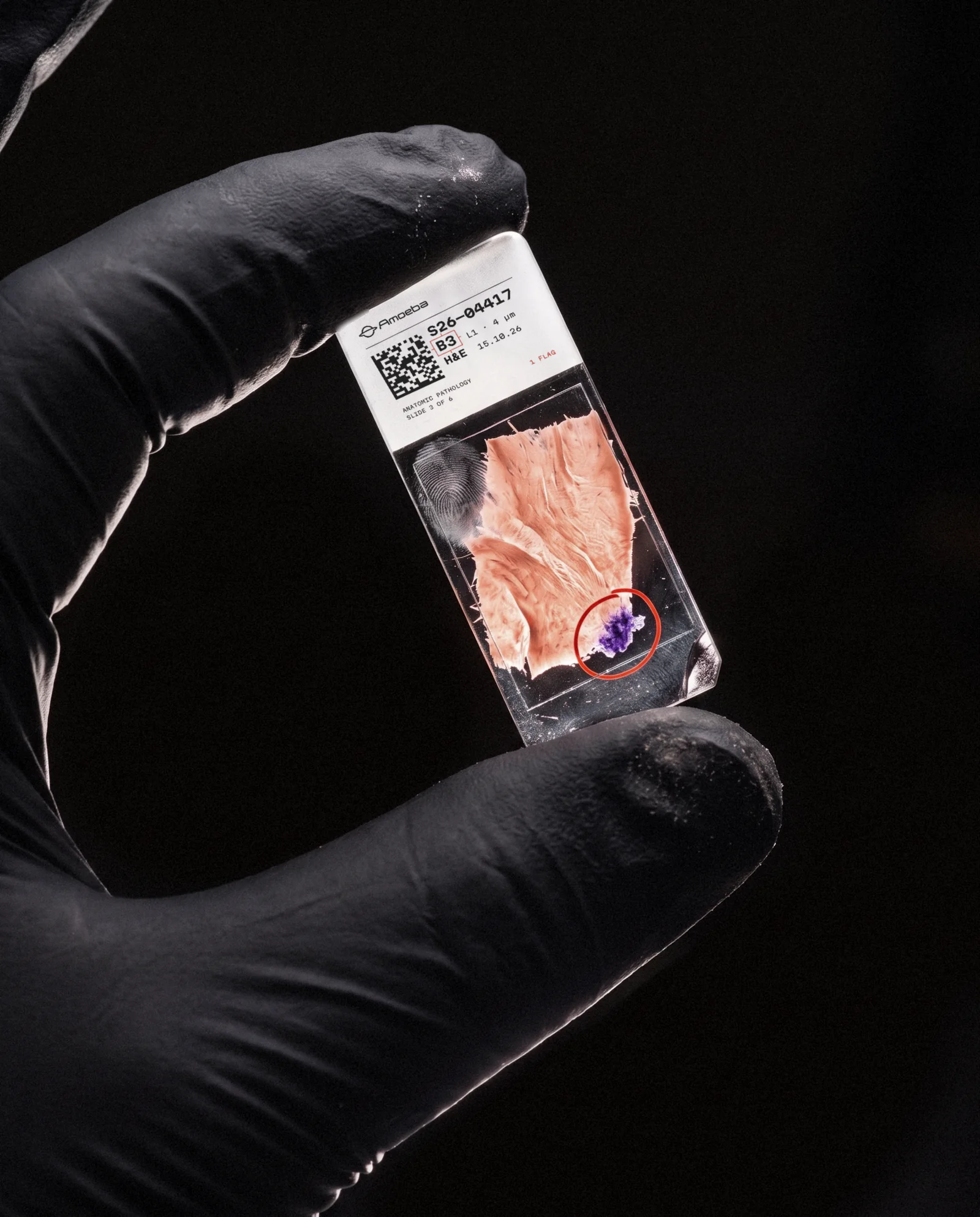 A gloved hand holds a glass slide with an Amoeba label and a red ring around a violet cluster