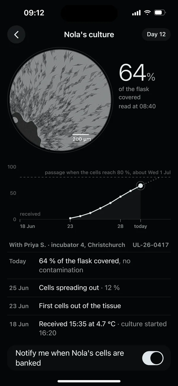 Field, culture: the flask on day 12, 64 percent covered
